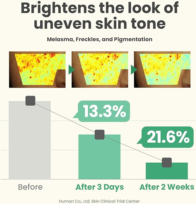 AXIS-Y Dark Spot Correcting Glow Serum | Clear, Bright & Even Skin Tone